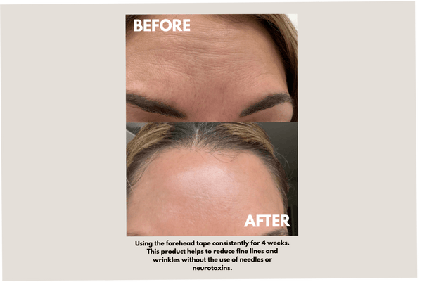 Seald™ Forehead Tape – Wrinkle Smoothing Patches - Blush & Cactus